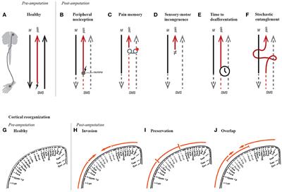 The Stochastic Entanglement and Phantom Motor Execution Hypotheses: A Theoretical Framework for the Origin and Treatment of Phantom Limb Pain